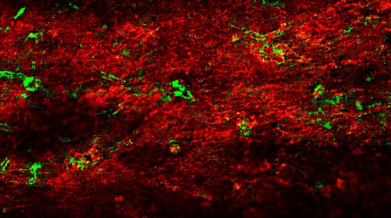 Ultra-wide field Raman imaging of rust distribution on the surface ...